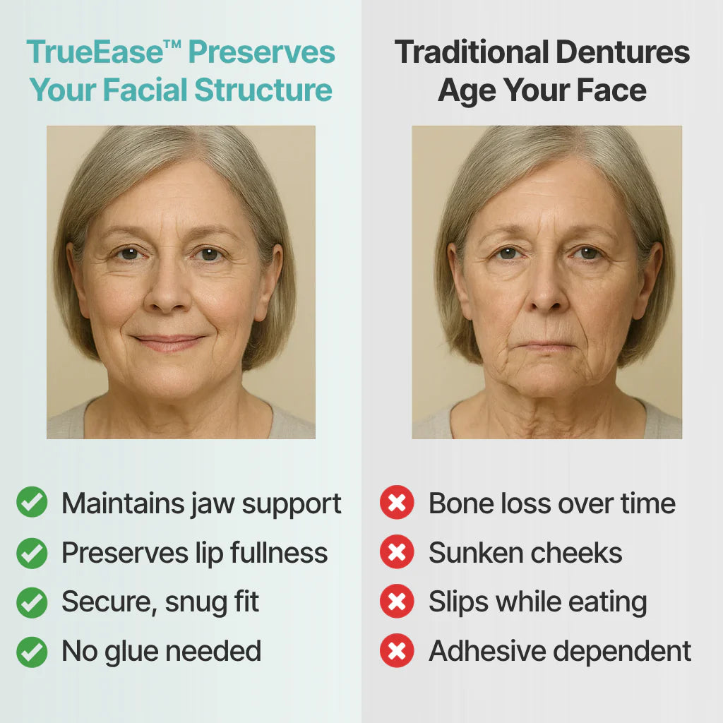 SmileCraft™ Custom-Fit Functional Dentures