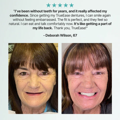 SmileCraft™ Custom-Fit Functional Dentures